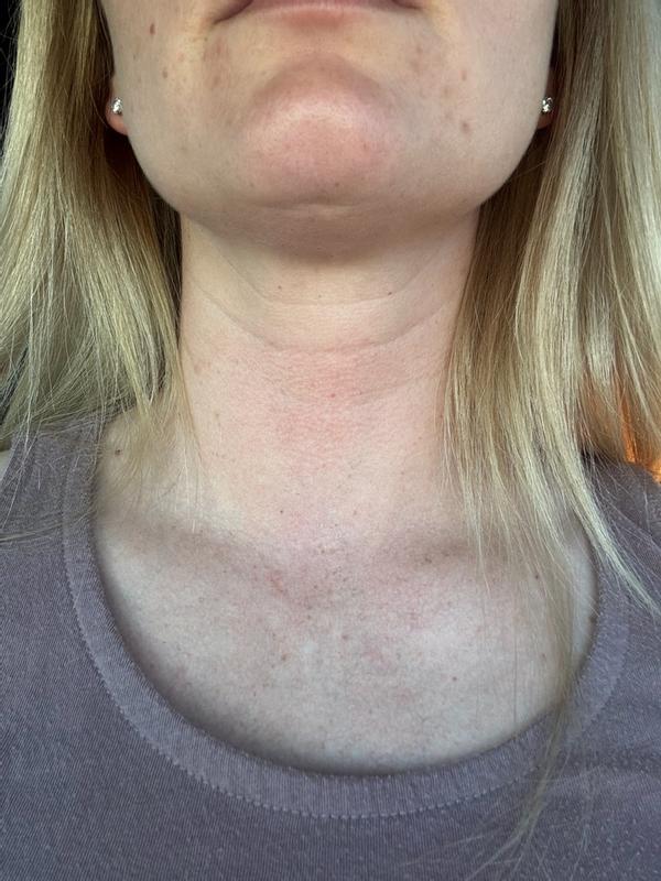 Review Thumbnail Image 0 299916519