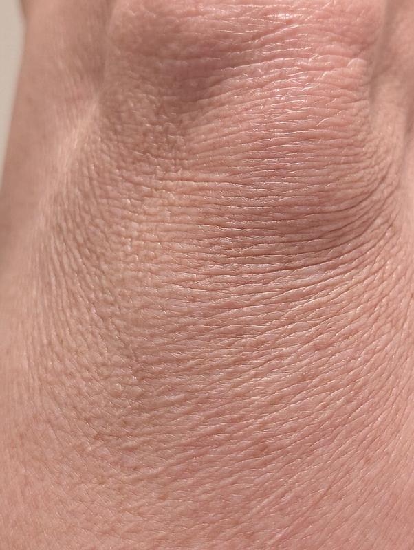 Review Thumbnail Image 0 301794050