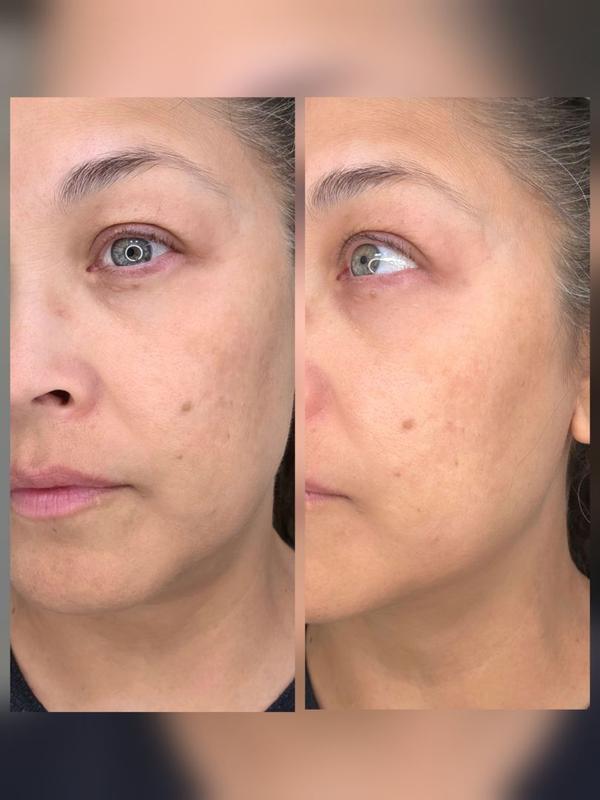 Review Thumbnail Image 1 299889619