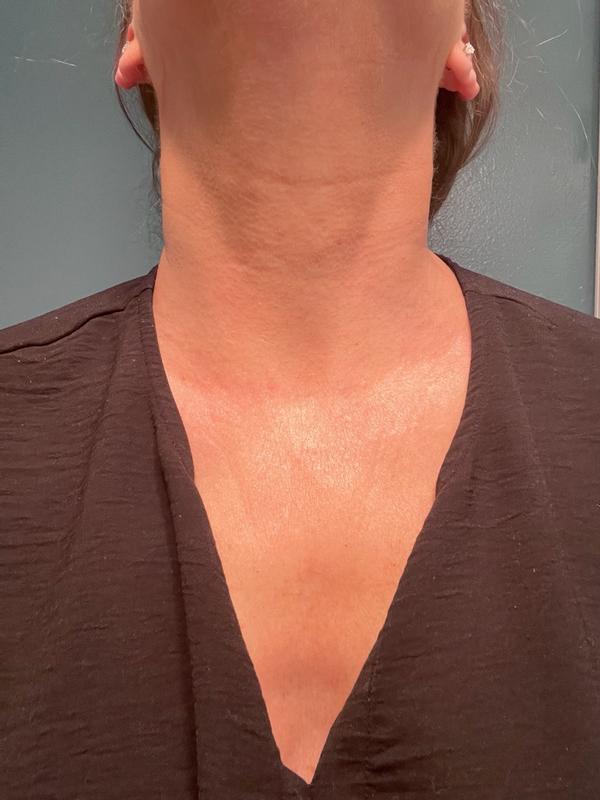 Review Thumbnail Image 1 300311693