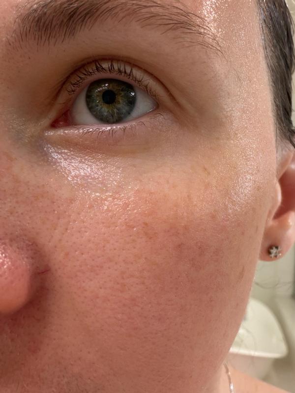Customer photo for "Lightweight, non-sticky serum that leaves my skin soft, smooth, and deeply hydrated."