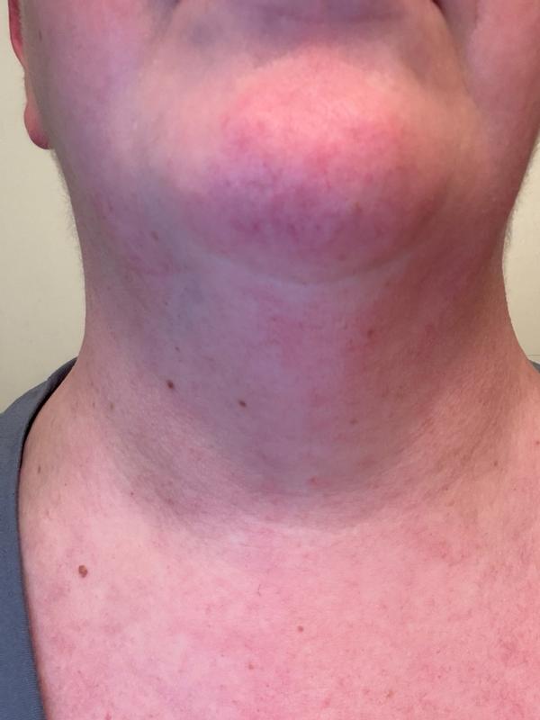 Review Thumbnail Image 1 299838384