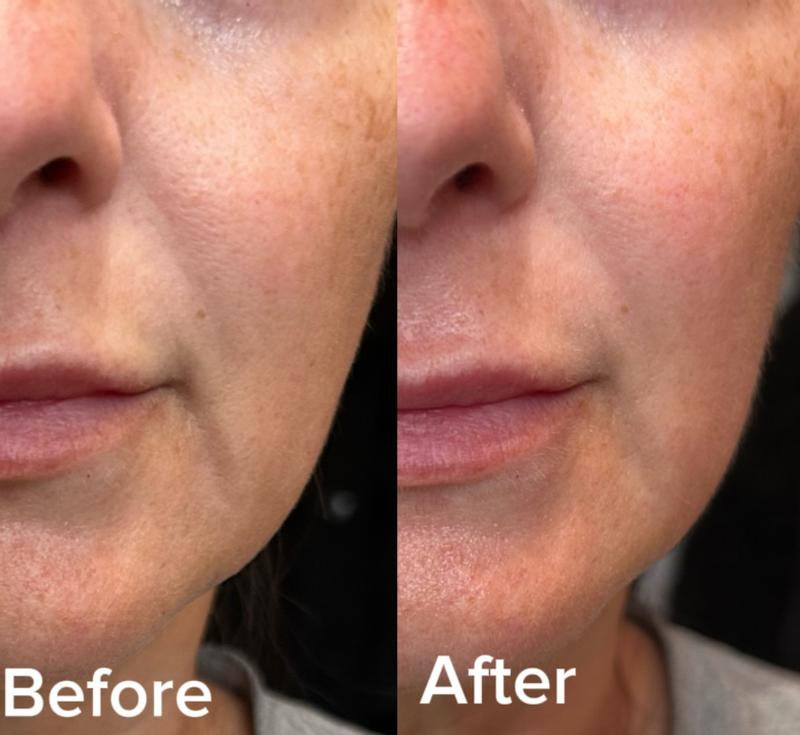 Review Thumbnail Image 0 300054248