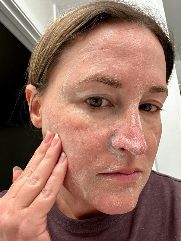 Customer photo for "Great for cleansing pores"