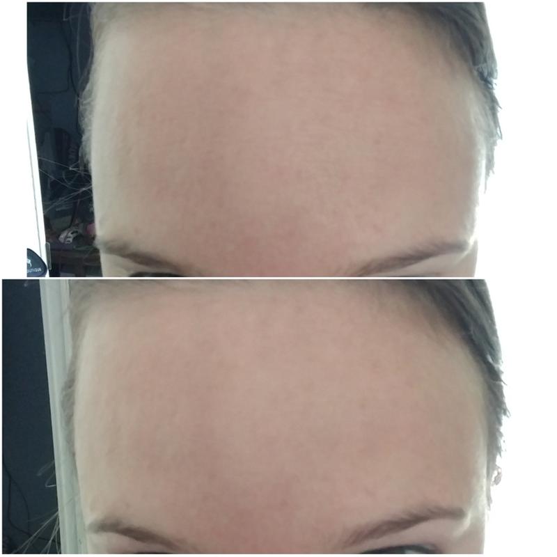 Before & After