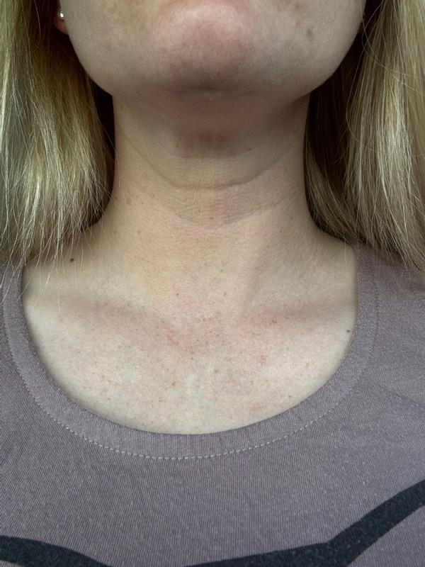 Review Thumbnail Image 1 299916519