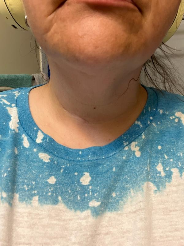 Review Thumbnail Image 0 299775122