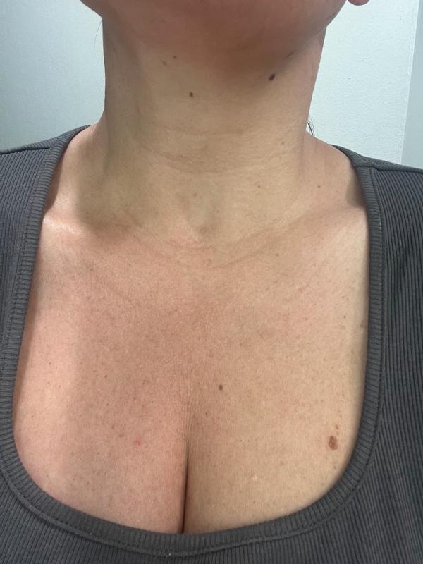 Review Thumbnail Image 0 299849587