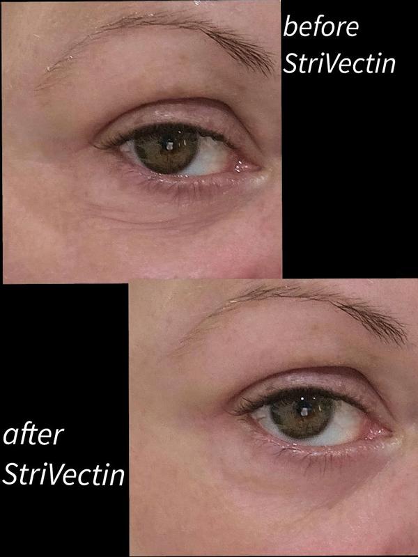 Review Thumbnail Image 0 300068160