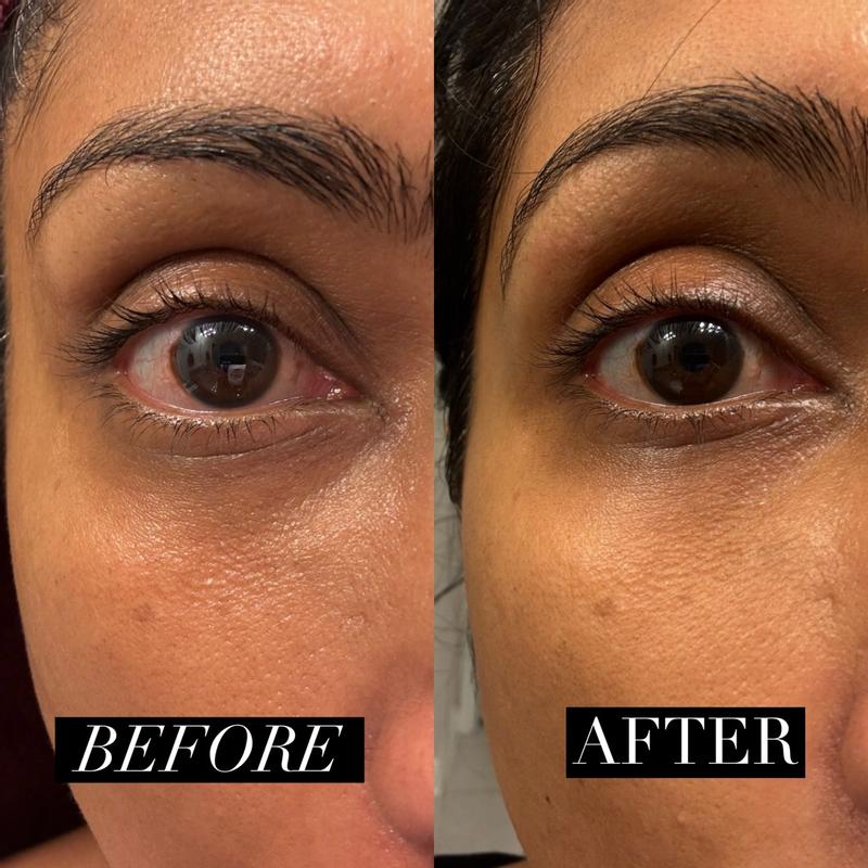 Customer photo for "No results"