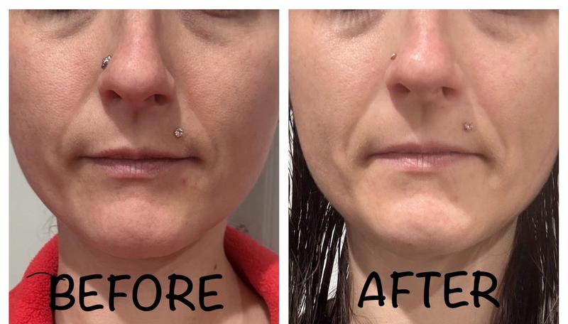 Review Thumbnail Image 0 300208208