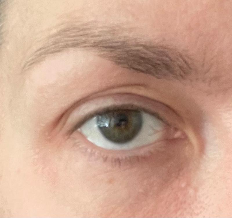 Customer photo for "Feels nice, but no visible results…"