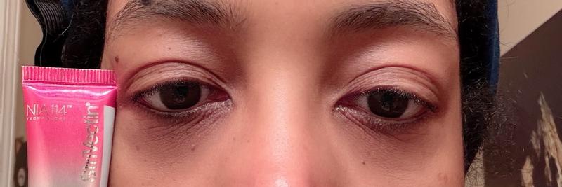 Customer photo for "Great Eye Cream"