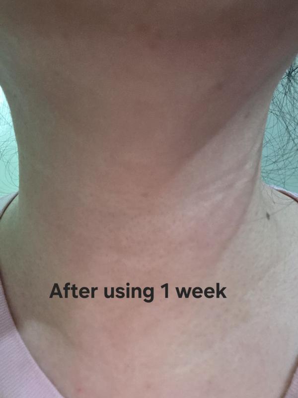 Review Thumbnail Image 2 300010157