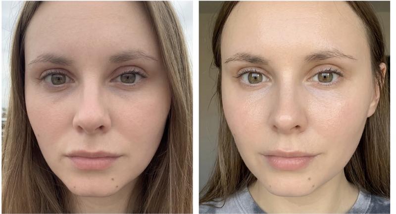 Customer carousel item 11.