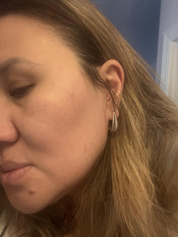 Customer carousel item 11.