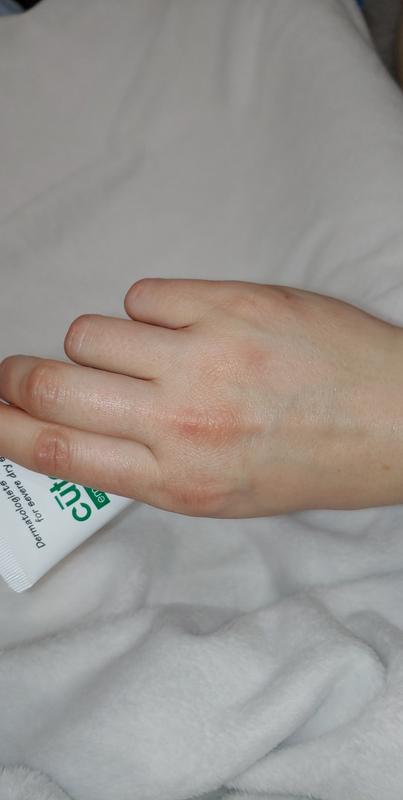 cutemol cream for nails