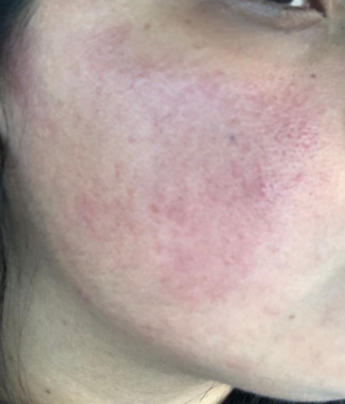 Photo submitted with review of product