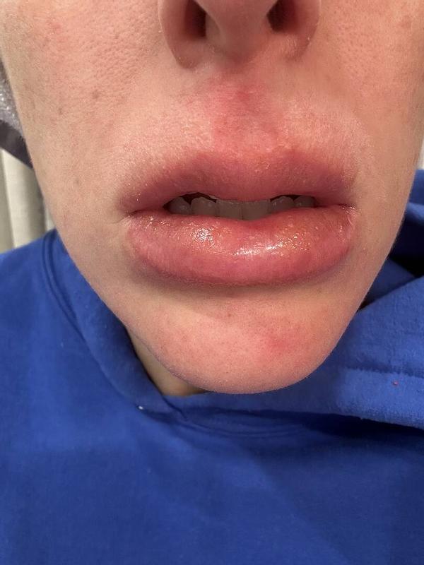 Photo submitted with review of product