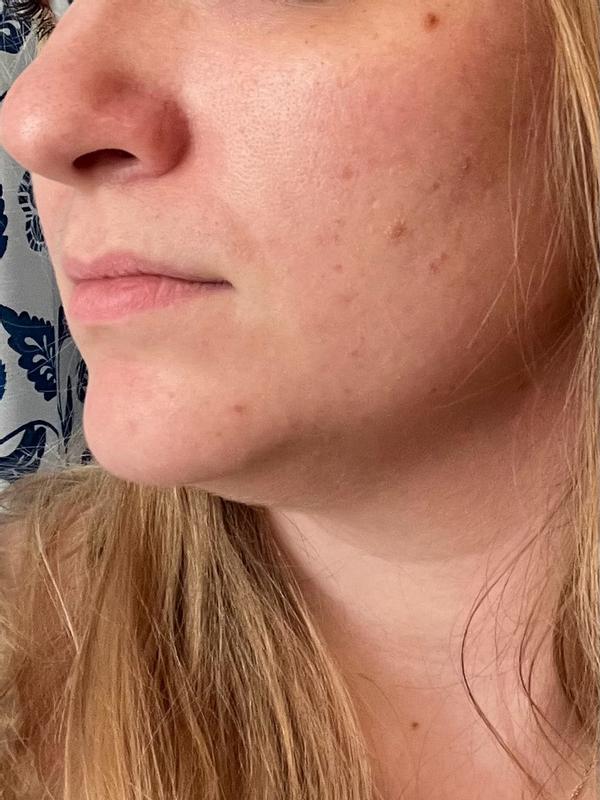 Review Thumbnail Image 0 383637561