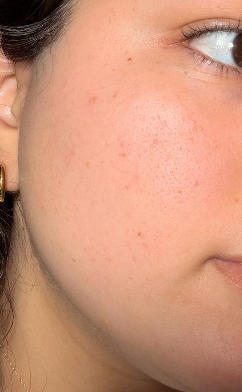 Review Thumbnail Image 1 382230450