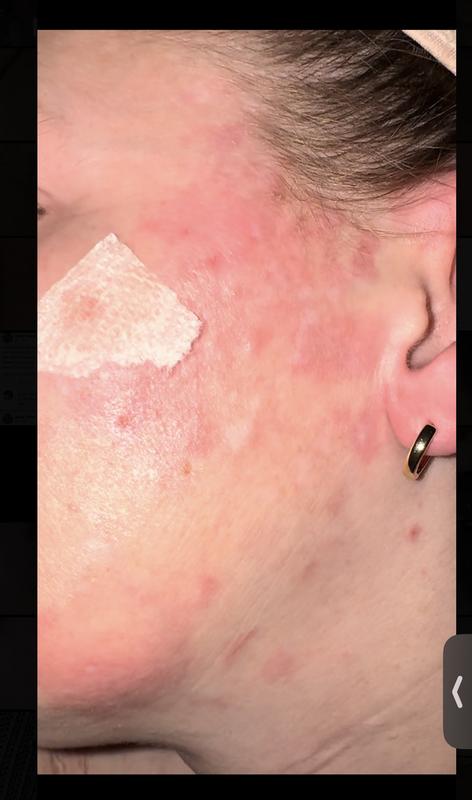 The day before I started adding LUNA to my routine (before)