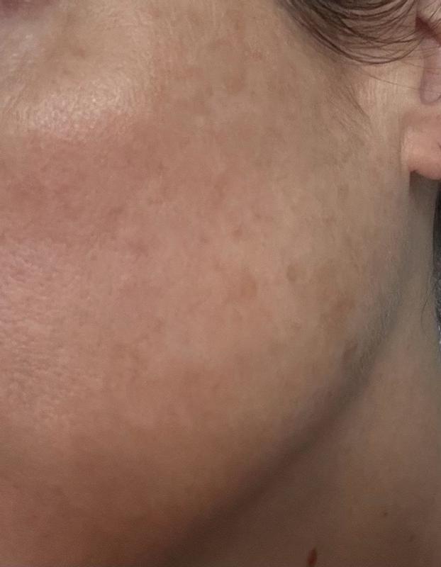 Review Thumbnail Image 0 382055739