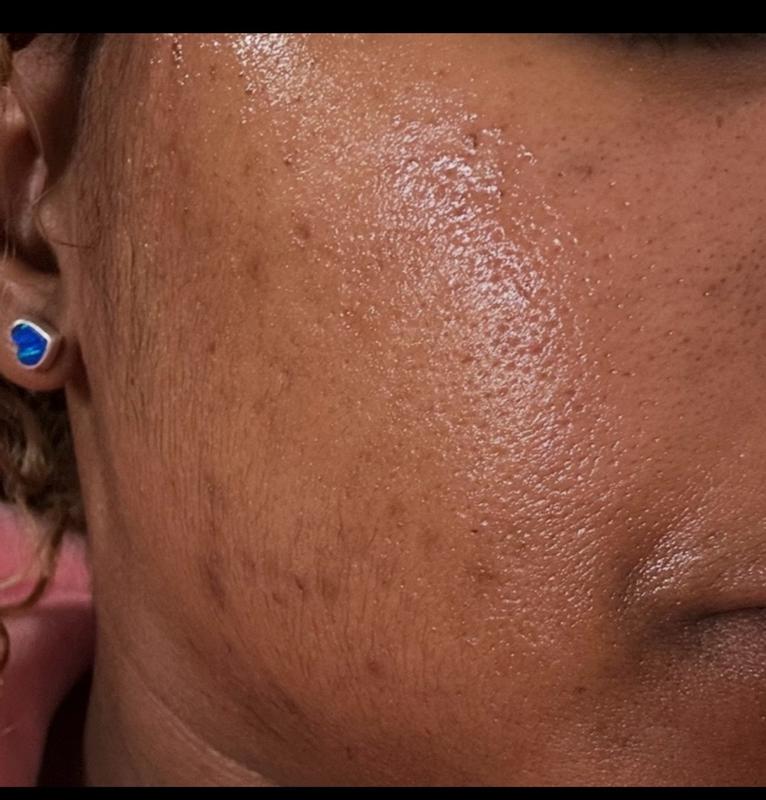 Review Thumbnail Image 0 382906744