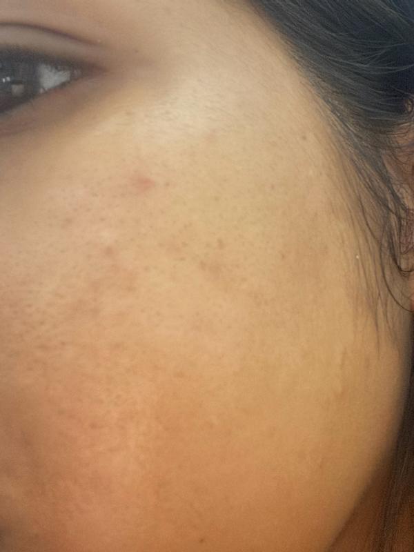 Review Thumbnail Image 0 379701127