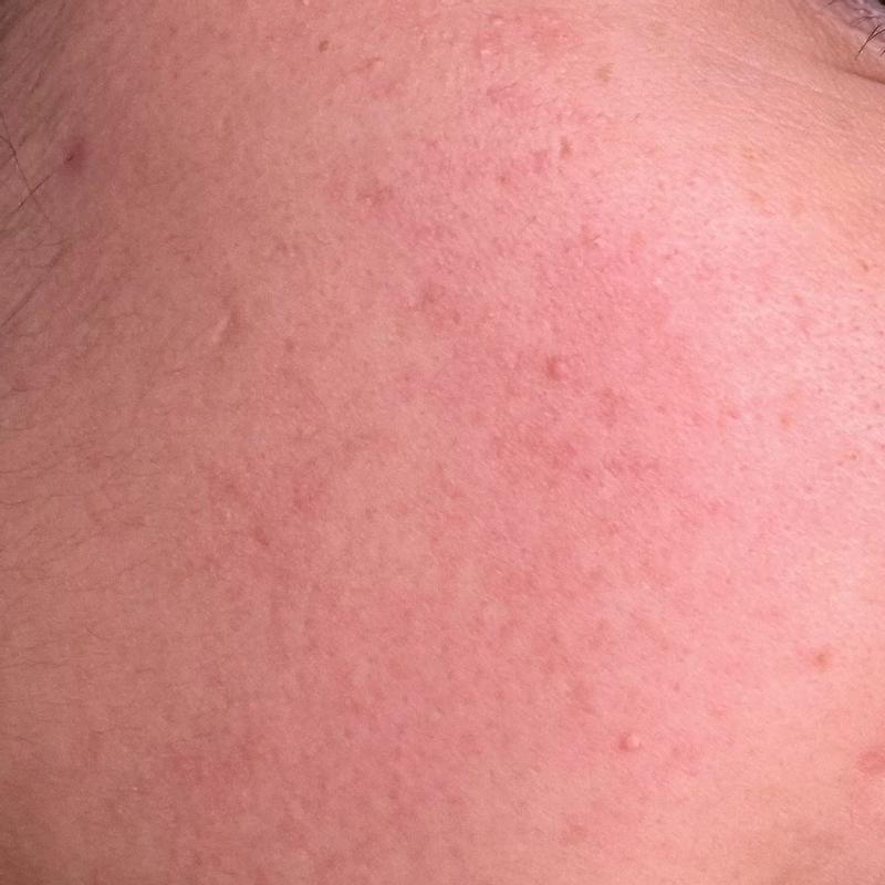 Review Thumbnail Image 4 382466307