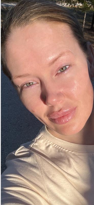 My skin NOW!!! Liquid gold! Prayers answered!