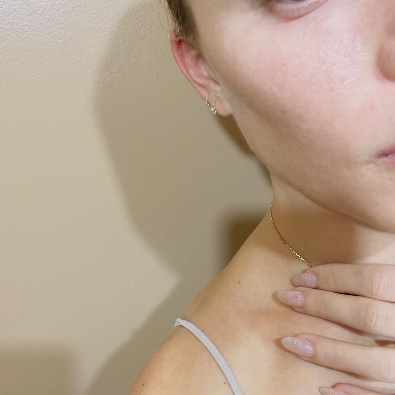 Before: fine lines, discoloration