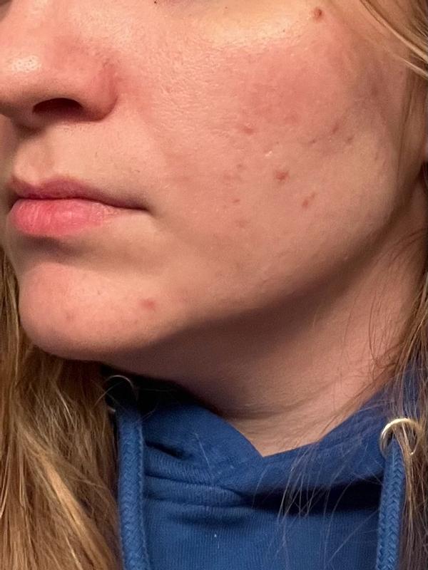 Review Thumbnail Image 1 383637561