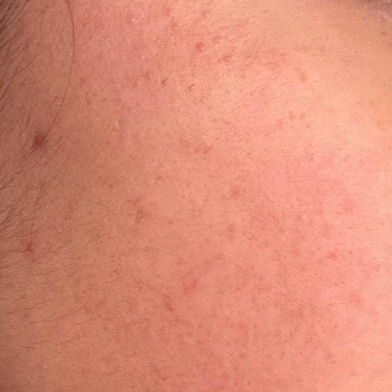 Review Thumbnail Image 3 382466307