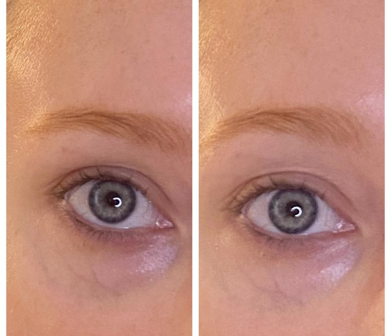 before/ after