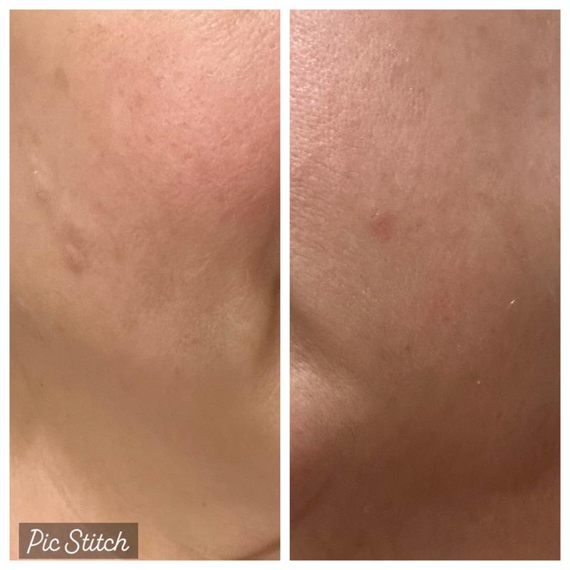 Review Thumbnail Image 1 383222463