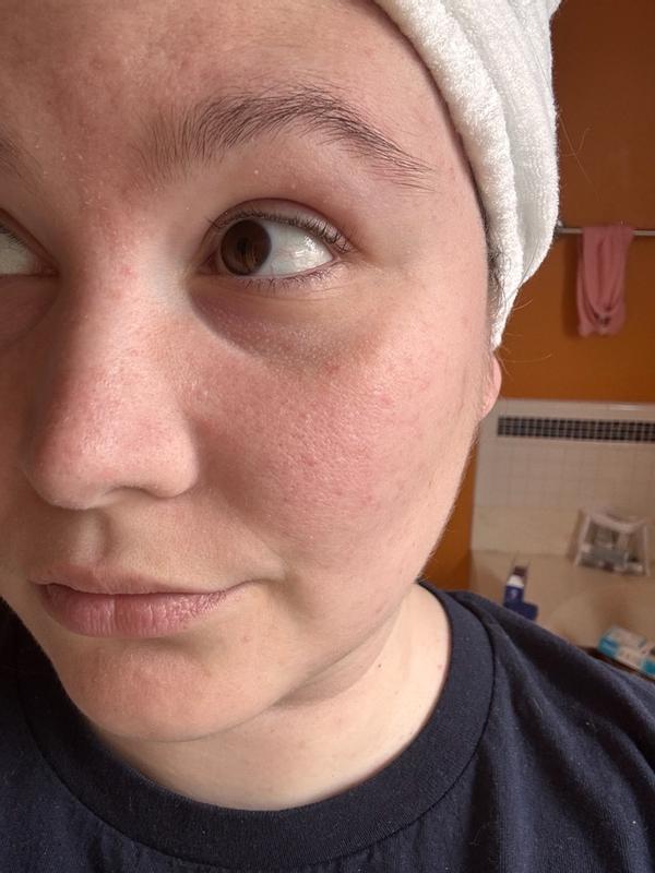 Review Thumbnail Image 1 383596066