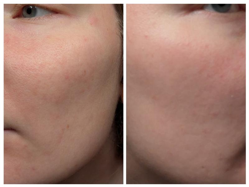 Review Thumbnail Image 0 383571305