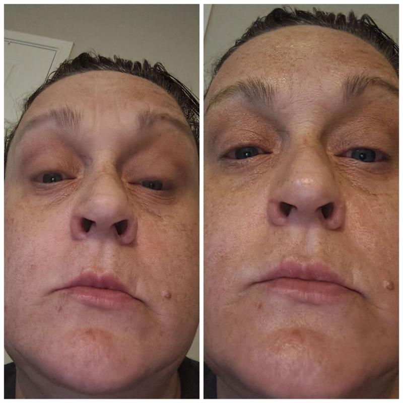 Review Thumbnail Image 0 382987240