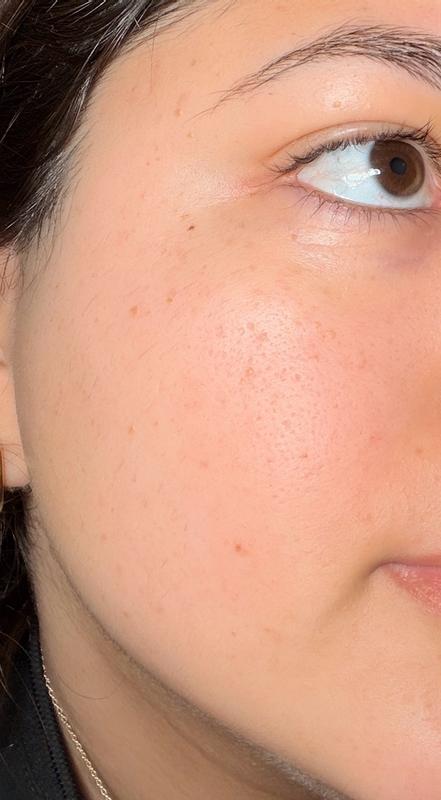 Review Thumbnail Image 0 382230450