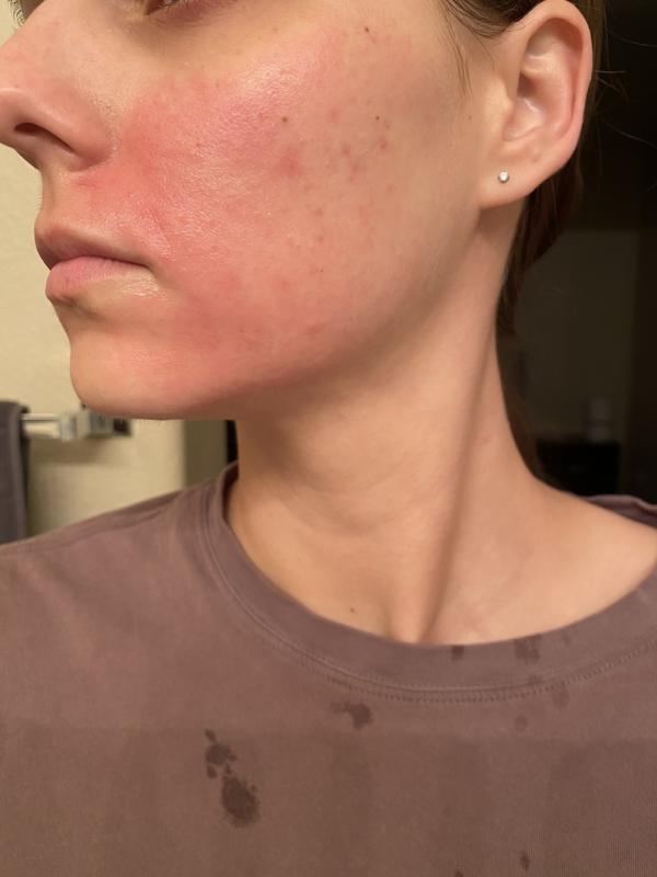 Photo submitted with review of product
