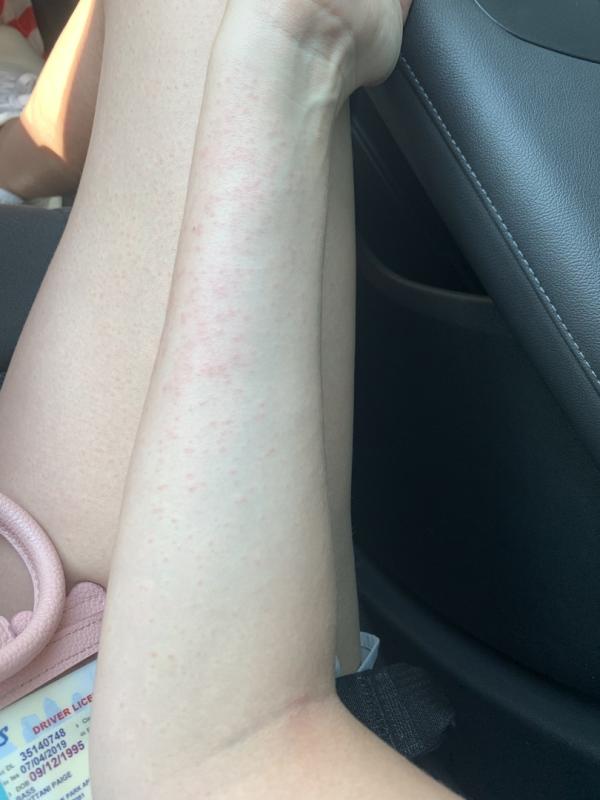 Photo submitted with review of product