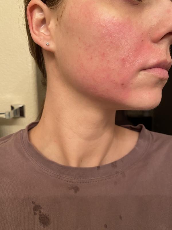 Photo submitted with review of product