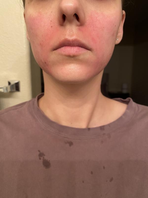 Photo submitted with review of product