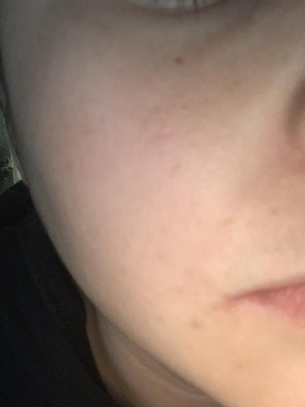 Photo submitted with review of product