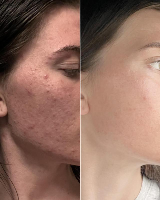 Review Thumbnail Image 0 379175521