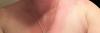 My poor skin