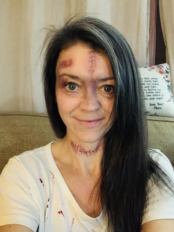 Amazing realistic stitches