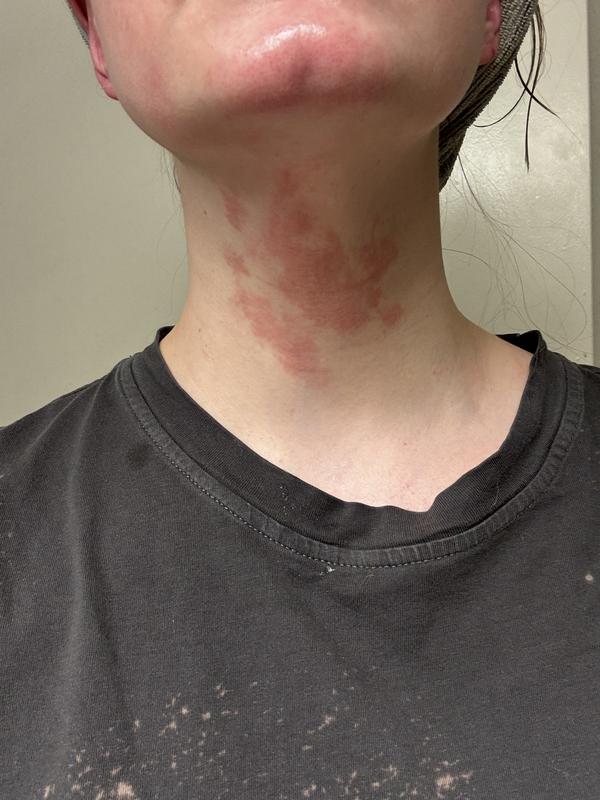 Review Thumbnail Image 0 344473152