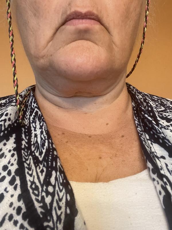 Customer photo for "Disappointing"